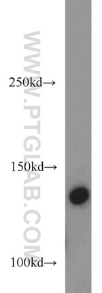 Collagen Type VI Antibody in Western Blot (WB)