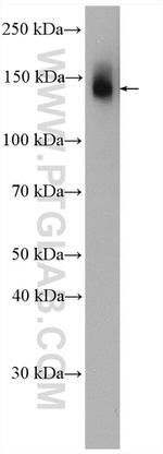 Collagen Type VI Antibody in Western Blot (WB)