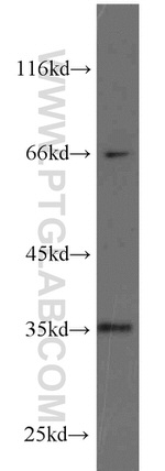 HSD17B7 Antibody in Western Blot (WB)