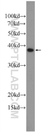 HSD17B7 Antibody in Western Blot (WB)
