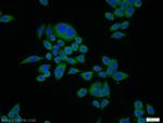 CTRL Antibody in Immunocytochemistry (ICC/IF)