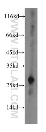 CTRL Antibody in Western Blot (WB)