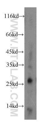 CTRL Antibody in Western Blot (WB)