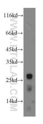 CTRL Antibody in Western Blot (WB)