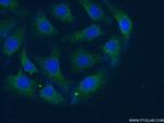 AKTIP Antibody in Immunocytochemistry (ICC/IF)