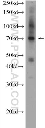 AKTIP Antibody in Western Blot (WB)