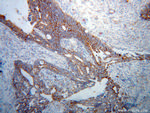 MCCC1 Antibody in Immunohistochemistry (Paraffin) (IHC (P))