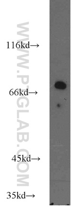 MCCC1 Antibody in Western Blot (WB)