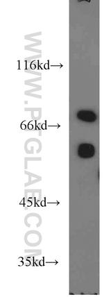 MCCC1 Antibody in Western Blot (WB)
