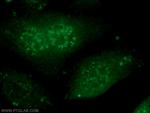 THOC5 Antibody in Immunocytochemistry (ICC/IF)