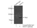 THOC5 Antibody in Immunoprecipitation (IP)