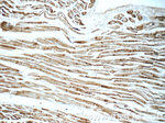 SDHA Antibody in Immunohistochemistry (Paraffin) (IHC (P))