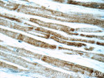 SDHA Antibody in Immunohistochemistry (Paraffin) (IHC (P))