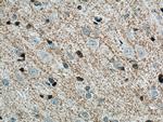 Plasmolipin Antibody in Immunohistochemistry (Paraffin) (IHC (P))