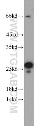 Calcipressin 1 Antibody in Western Blot (WB)