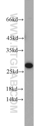 Calcipressin 1 Antibody in Western Blot (WB)