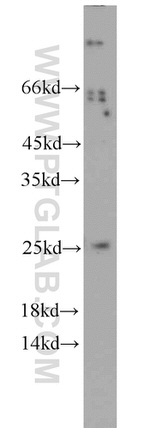 Calcipressin 1 Antibody in Western Blot (WB)