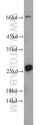 Calcipressin 1 Antibody in Western Blot (WB)