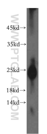 Calcipressin 1 Antibody in Western Blot (WB)
