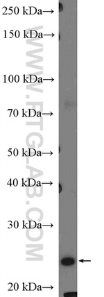 Calcipressin 1 Antibody in Western Blot (WB)