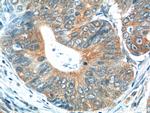 Calcipressin 1 Antibody in Immunohistochemistry (Paraffin) (IHC (P))