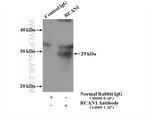 Calcipressin 1 Antibody in Immunoprecipitation (IP)
