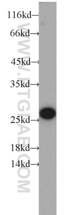 Calcipressin 1 Antibody in Western Blot (WB)