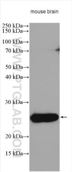 Calcipressin 1 Antibody in Western Blot (WB)