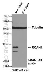 Calcipressin 1 Antibody in Western Blot (WB)