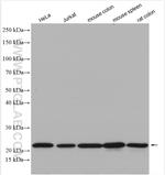 SPCS2 Antibody in Western Blot (WB)