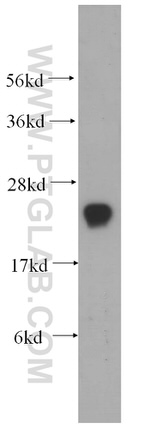 SPCS2 Antibody in Western Blot (WB)