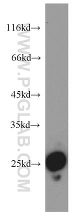 SPCS2 Antibody in Western Blot (WB)