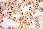 POLM Antibody in Immunohistochemistry (Paraffin) (IHC (P))