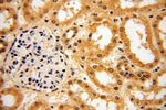POLM Antibody in Immunohistochemistry (Paraffin) (IHC (P))