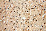 POLM Antibody in Immunohistochemistry (Paraffin) (IHC (P))