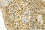 BASP1 Antibody in Immunohistochemistry (Paraffin) (IHC (P))