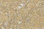 BASP1 Antibody in Immunohistochemistry (Paraffin) (IHC (P))