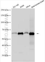 BASP1 Antibody in Western Blot (WB)
