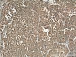 NARS Antibody in Immunohistochemistry (Paraffin) (IHC (P))