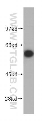 NARS Antibody in Western Blot (WB)