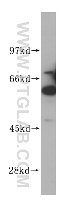 NARS Antibody in Western Blot (WB)