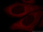 Aldolase C Antibody in Immunocytochemistry (ICC/IF)