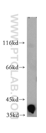Aldolase C Antibody in Western Blot (WB)