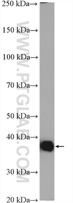 Aldolase C Antibody in Western Blot (WB)