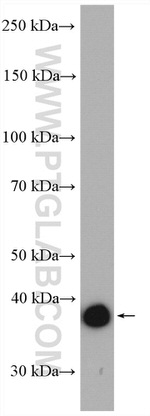 Aldolase C Antibody in Western Blot (WB)