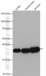 Aldolase C Antibody in Western Blot (WB)
