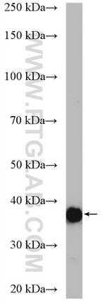 Aldolase C Antibody in Western Blot (WB)