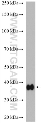 Aldolase C Antibody in Western Blot (WB)
