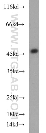 GOT1 Antibody in Western Blot (WB)