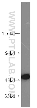 GOT1 Antibody in Western Blot (WB)